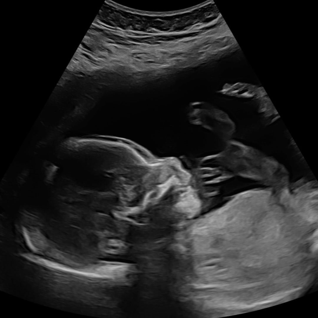Photo shared by Jessica for their Babylist baby registry.