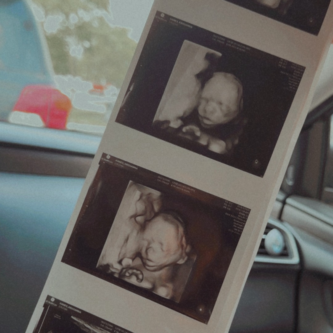 Photo shared by Krissanna for their Babylist baby registry.