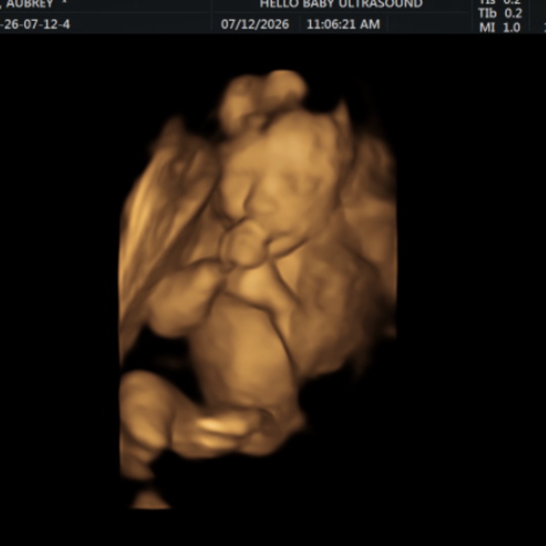 Photo shared by Aubrey for their Babylist baby registry.