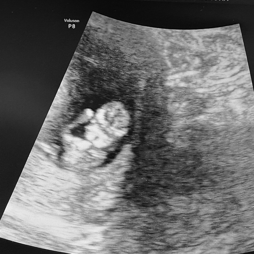 Photo shared by Rebecca for their Babylist baby registry.