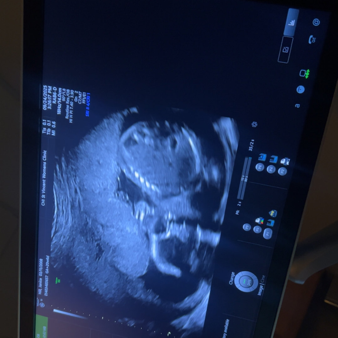 Photo shared by Shyanna for their Babylist baby registry.