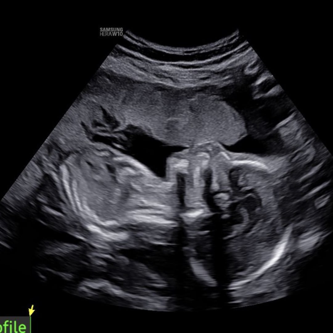 Photo shared by Rachel for their Babylist baby registry.