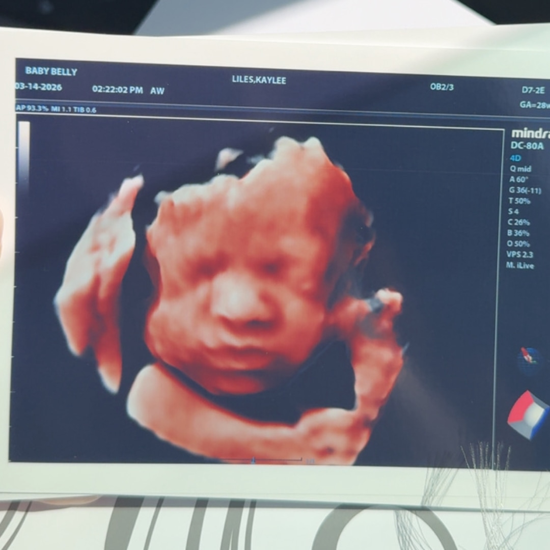 Photo shared by Kaylee for their Babylist baby registry.