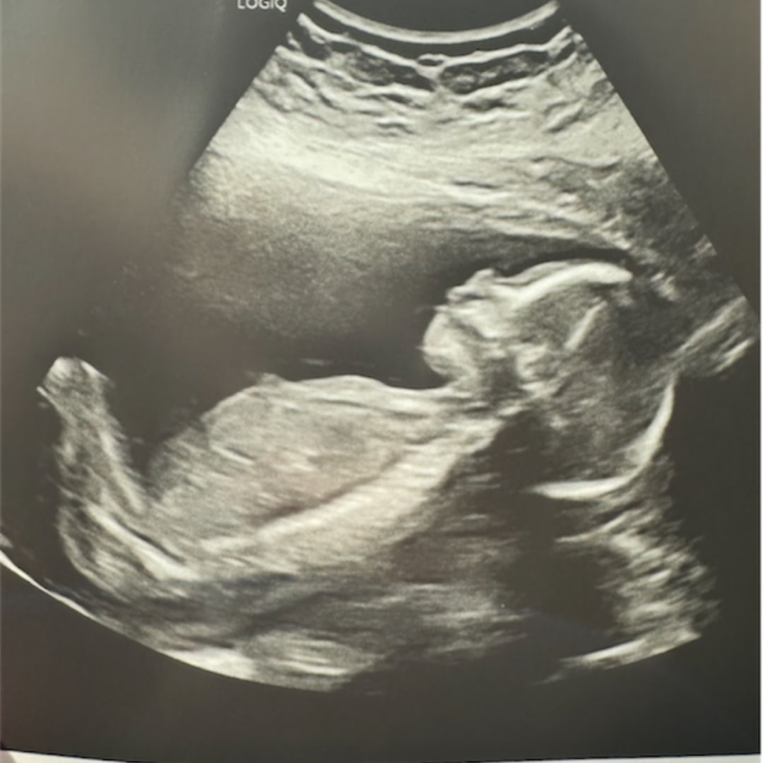 Photo shared by Cynthia for their Babylist baby registry.