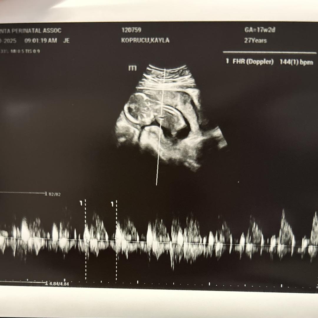 Photo shared by Kayla for their Babylist baby registry.
