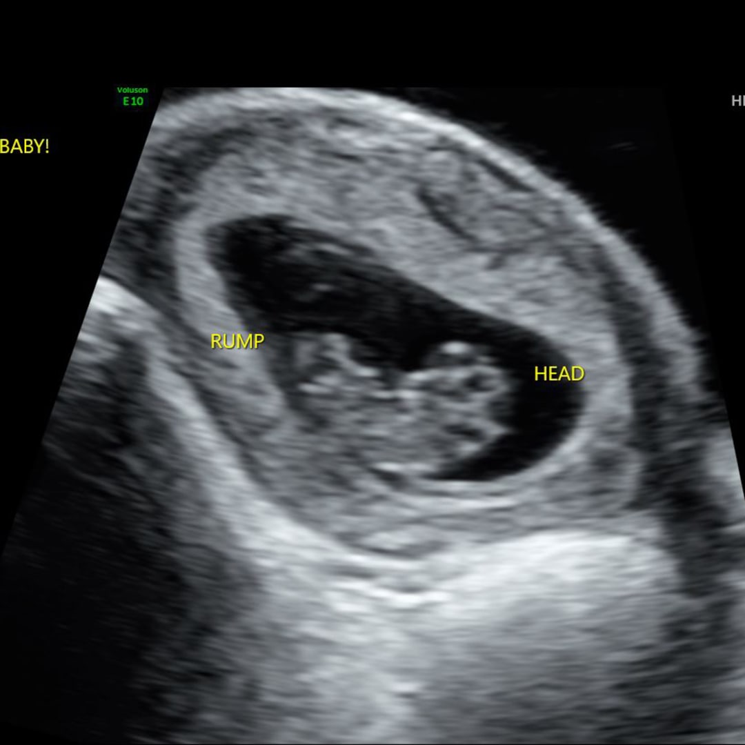 Photo shared by Lauren for their Babylist baby registry.