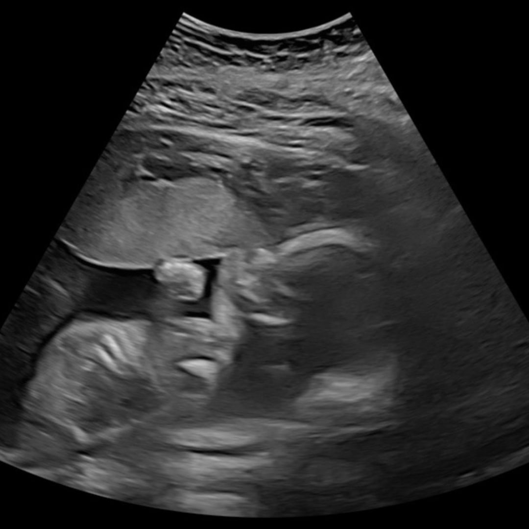 Photo shared by Corinne for their Babylist baby registry.