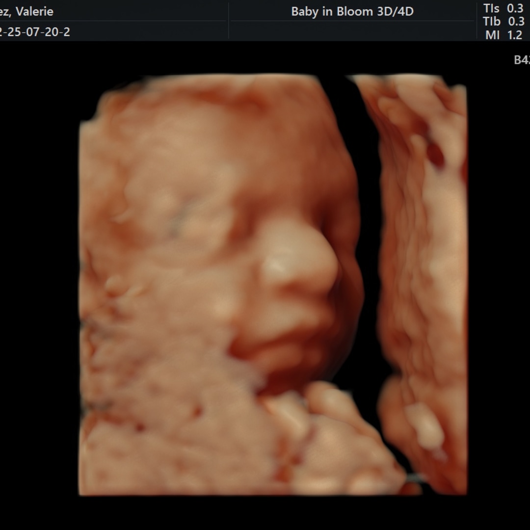 Photo shared by Valerie for their Babylist baby registry.