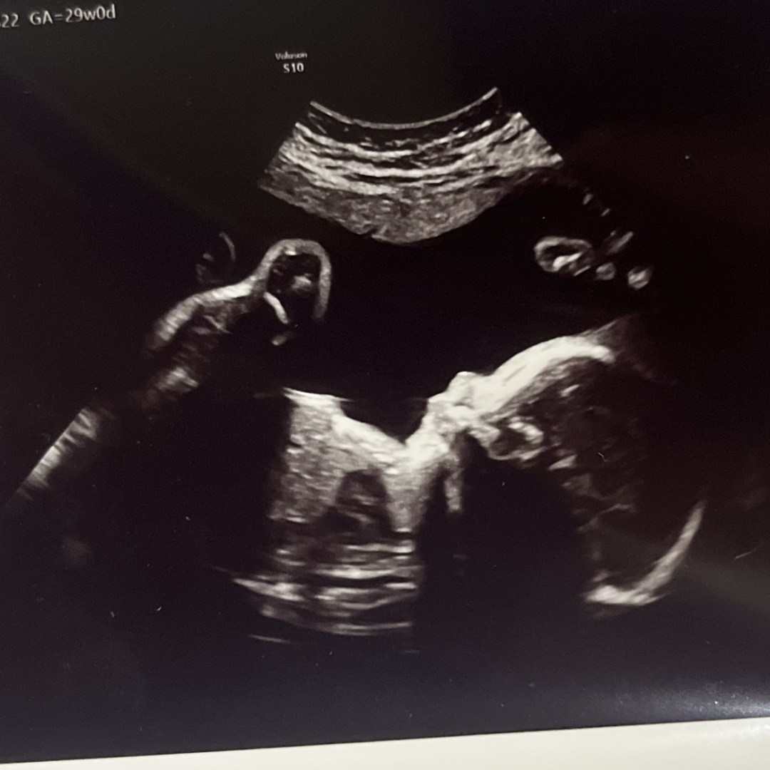 Photo shared by Lauren for their Babylist baby registry.