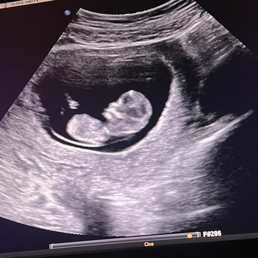 Photo shared by Emily for their Babylist baby registry.