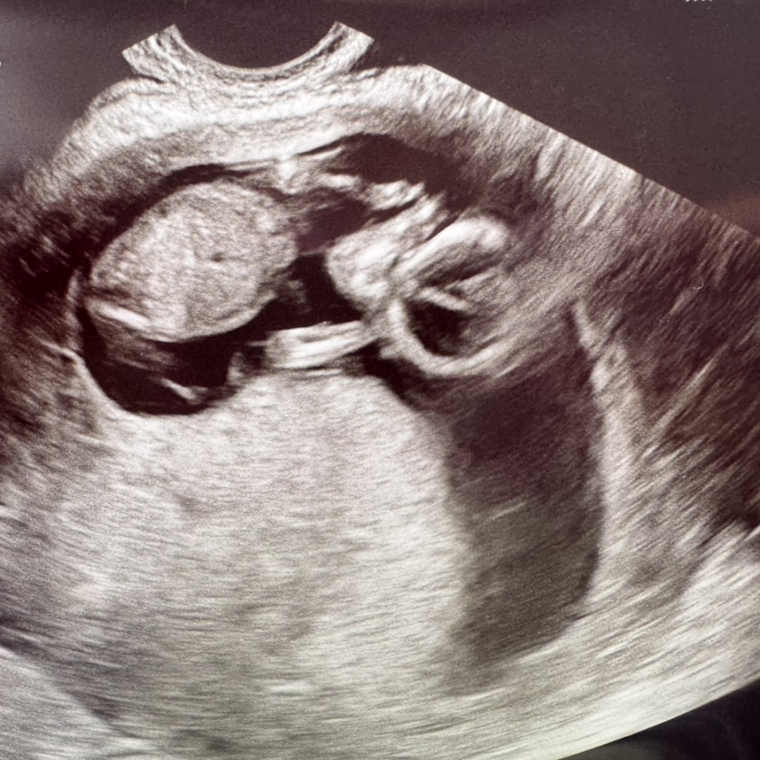 Photo shared by Madelynn for their Babylist baby registry.