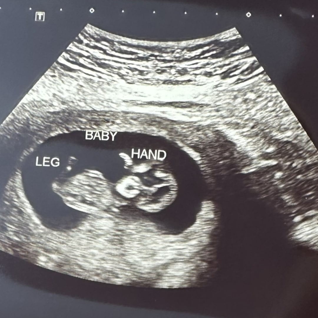 Photo shared by Courtney for their Babylist baby registry.
