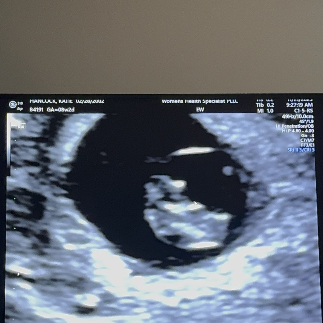 Photo shared by Katie for their Babylist baby registry.