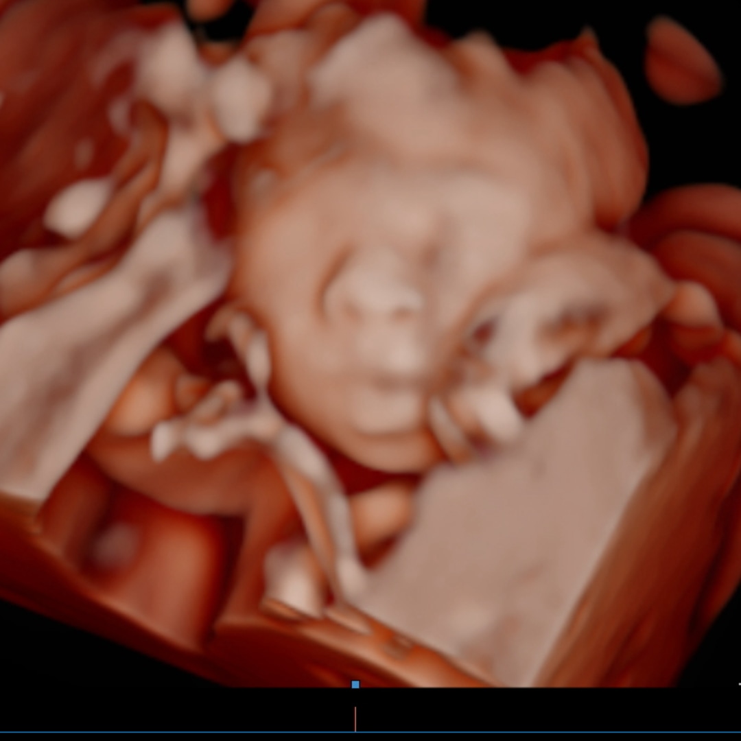 Photo shared by Deja for their Babylist baby registry.