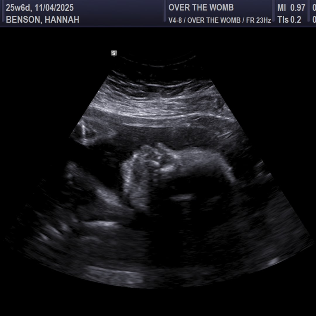 Photo shared by Hannah for their Babylist baby registry.