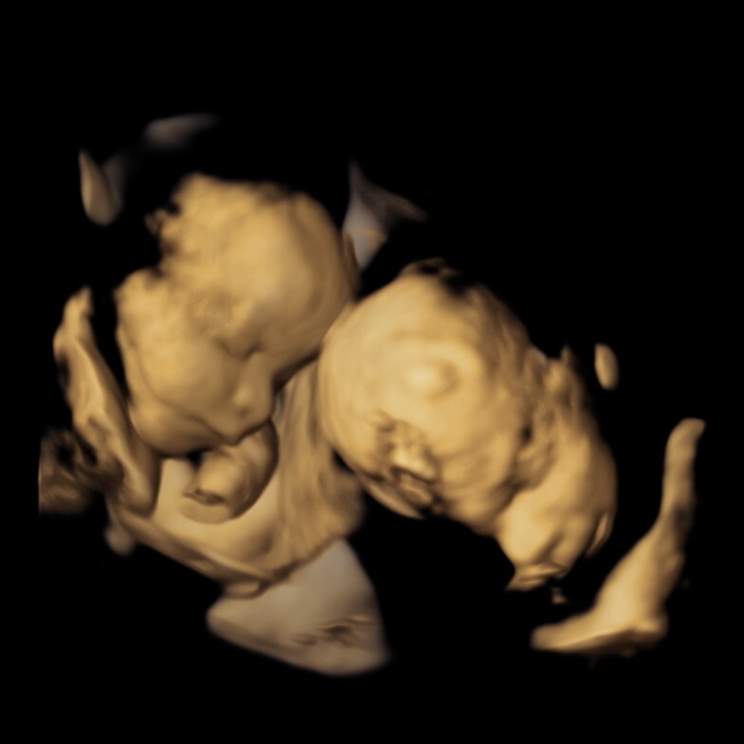 Photo shared by Autumn for their Babylist baby registry.