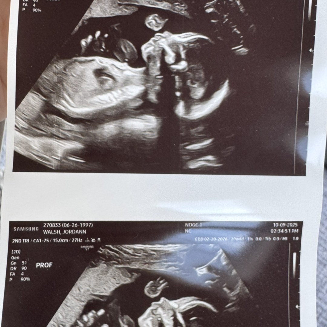 Photo shared by Jordann for their Babylist baby registry.