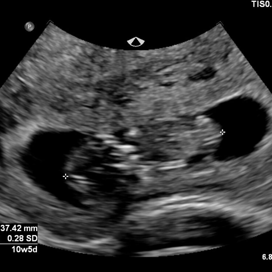 Photo shared by Bayley for their Babylist baby registry.