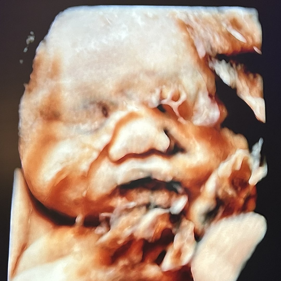 Photo shared by Alyesha for their Babylist baby registry.