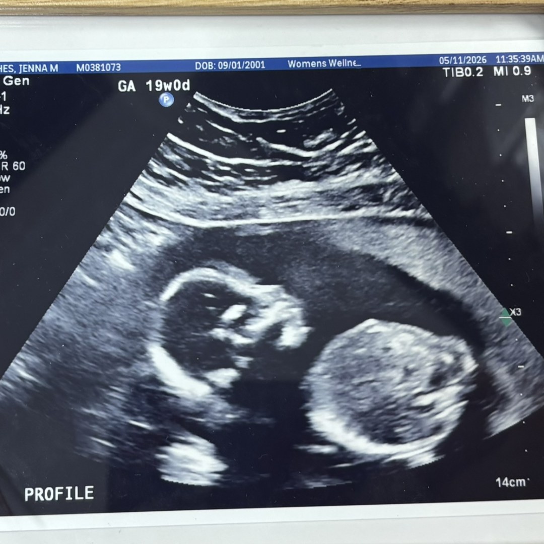 Photo shared by Jenna for their Babylist baby registry.