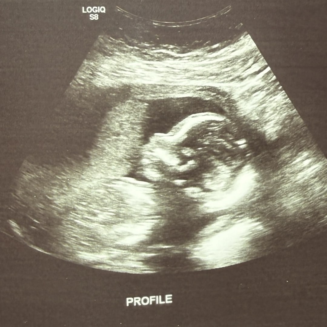 Photo shared by Janet for their Babylist baby registry.