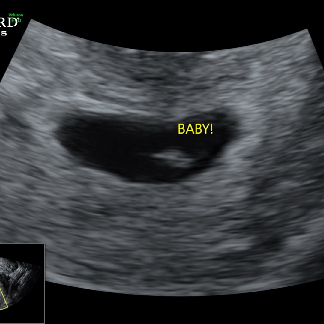 Photo shared by Emily for their Babylist baby registry.