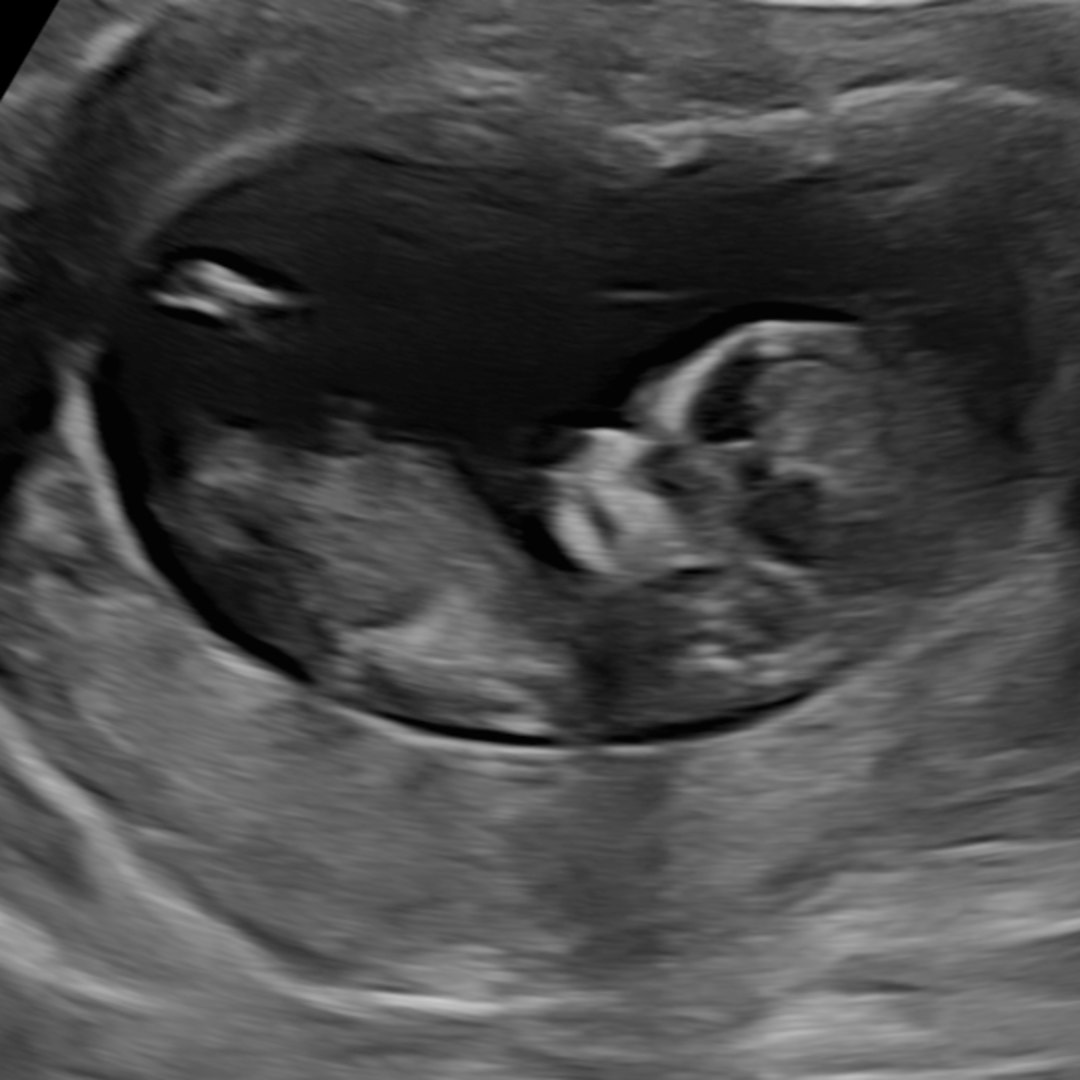 Photo shared by Sarah for their Babylist baby registry.