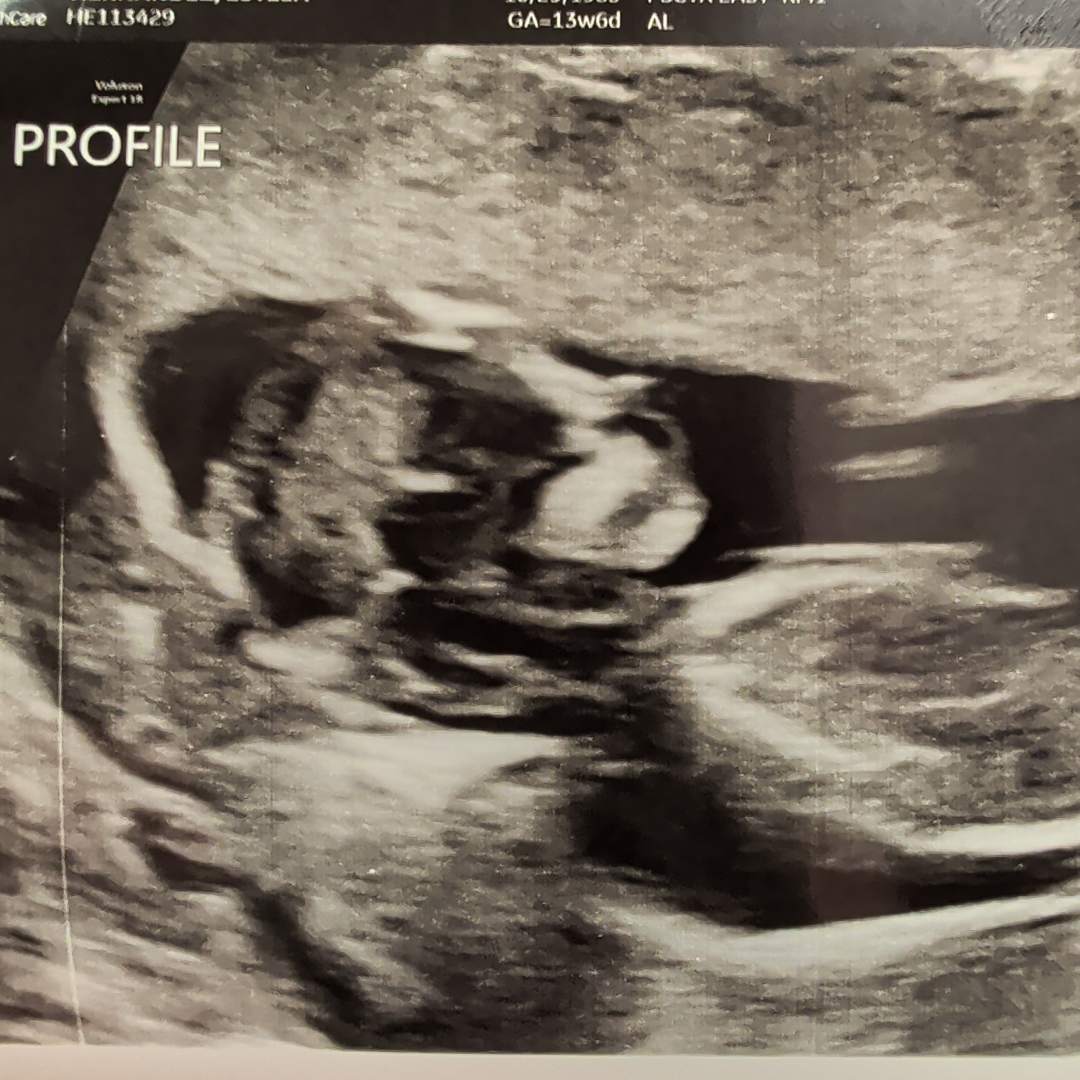 Photo shared by Aletseconny for their Babylist baby registry.