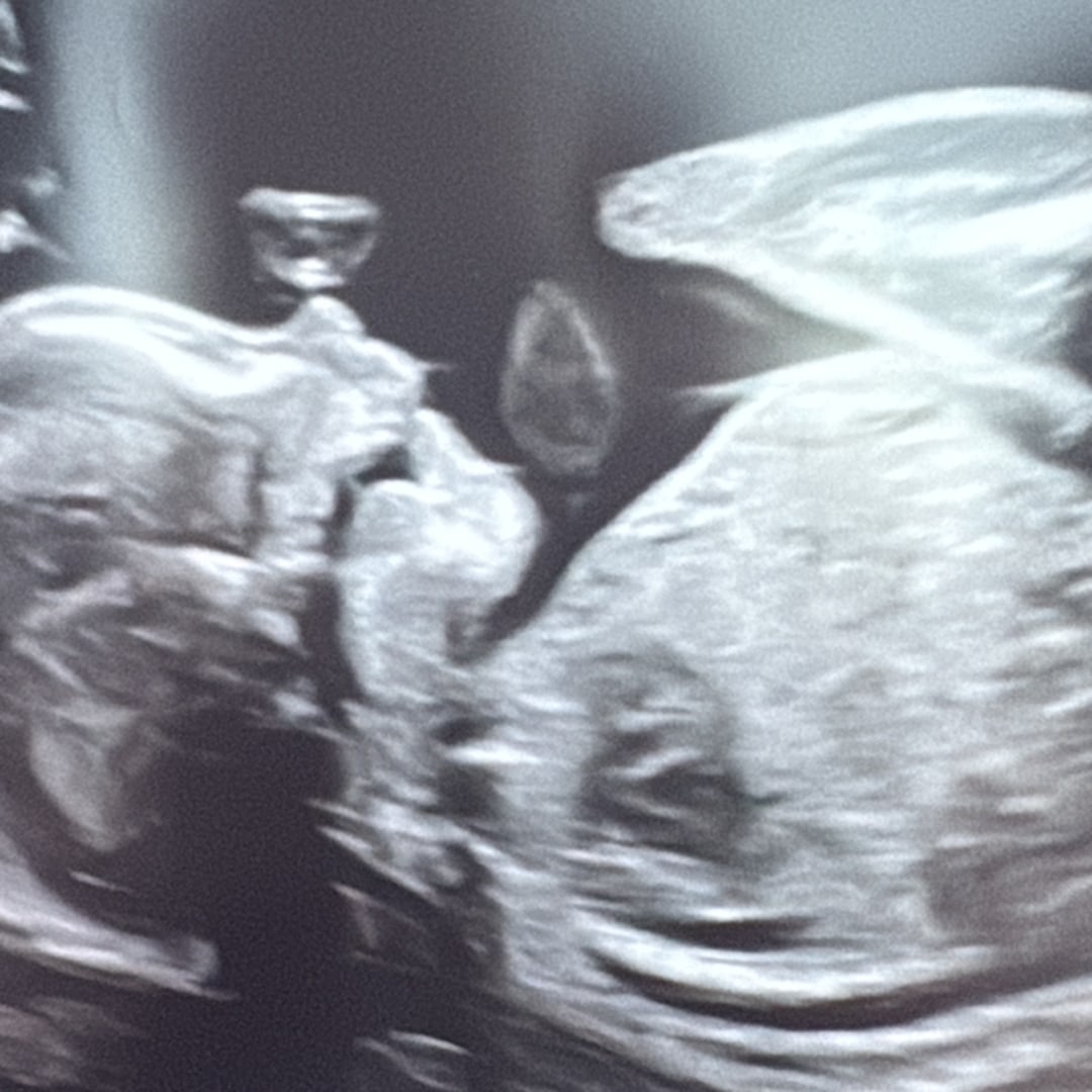 Photo shared by Kristie for their Babylist baby registry.