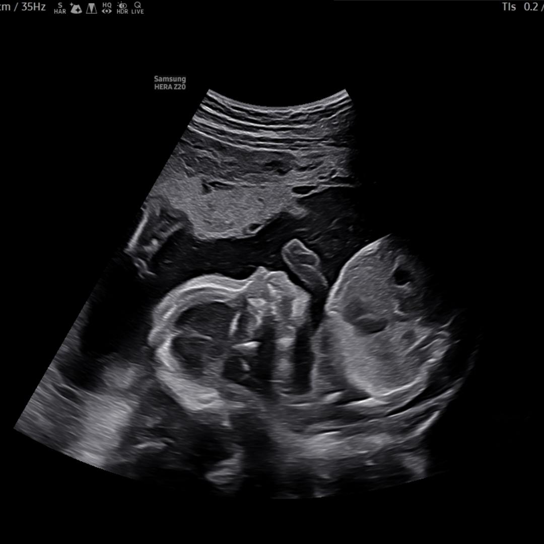 Photo shared by Catherine for their Babylist baby registry.