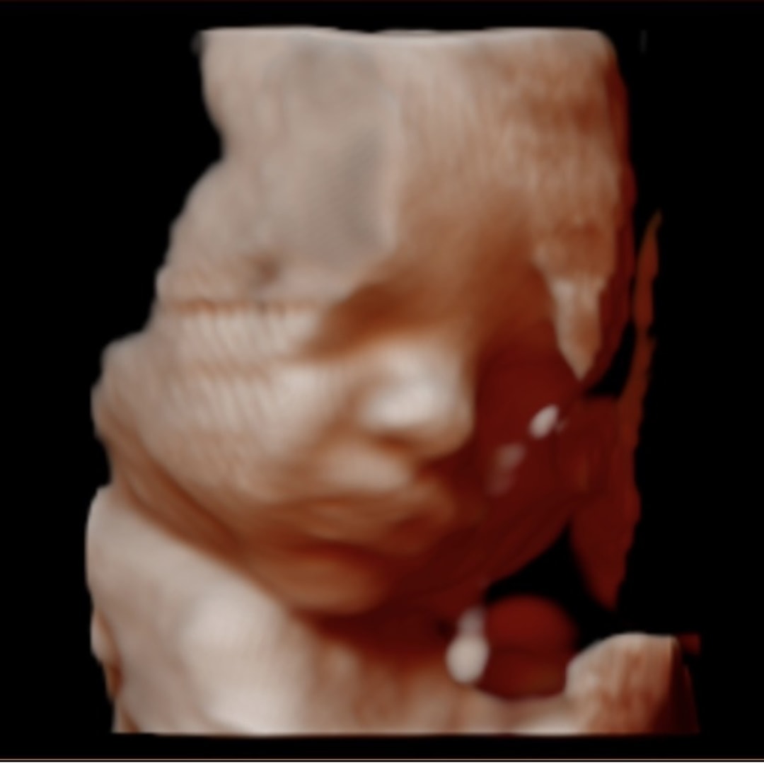 Photo shared by Aleigha for their Babylist baby registry.