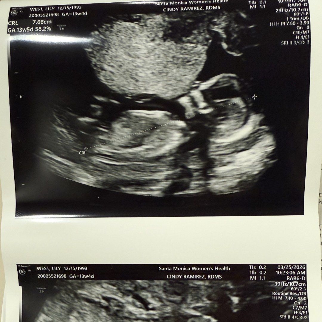 Photo shared by Lillie for their Babylist baby registry.