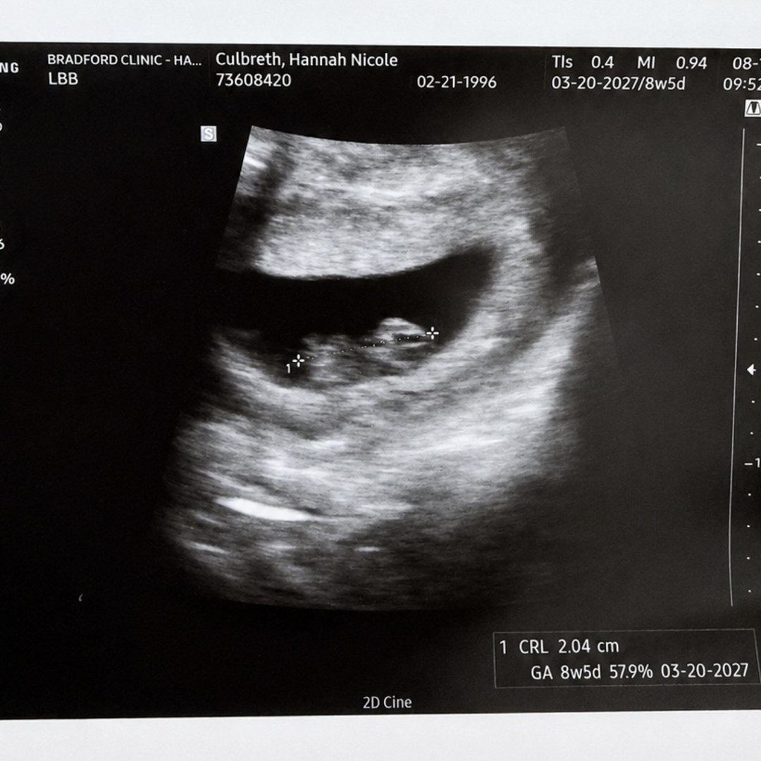 Photo shared by Hannah for their Babylist baby registry.