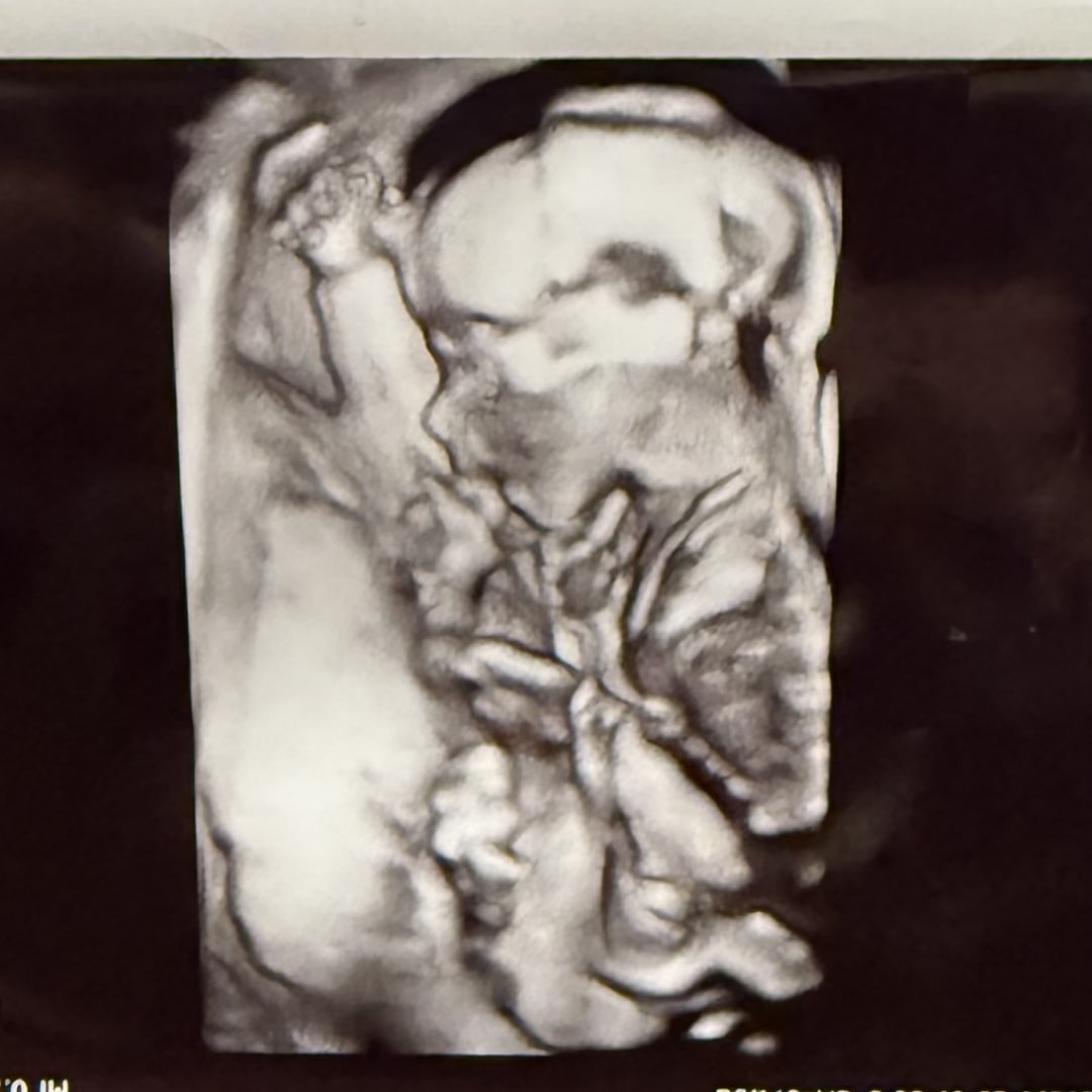 Photo shared by Kenedee for their Babylist baby registry.