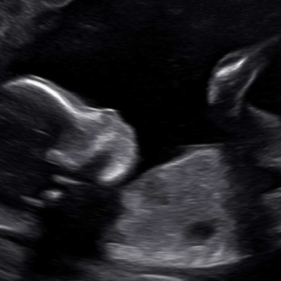 Photo shared by Claudia for their Babylist baby registry.