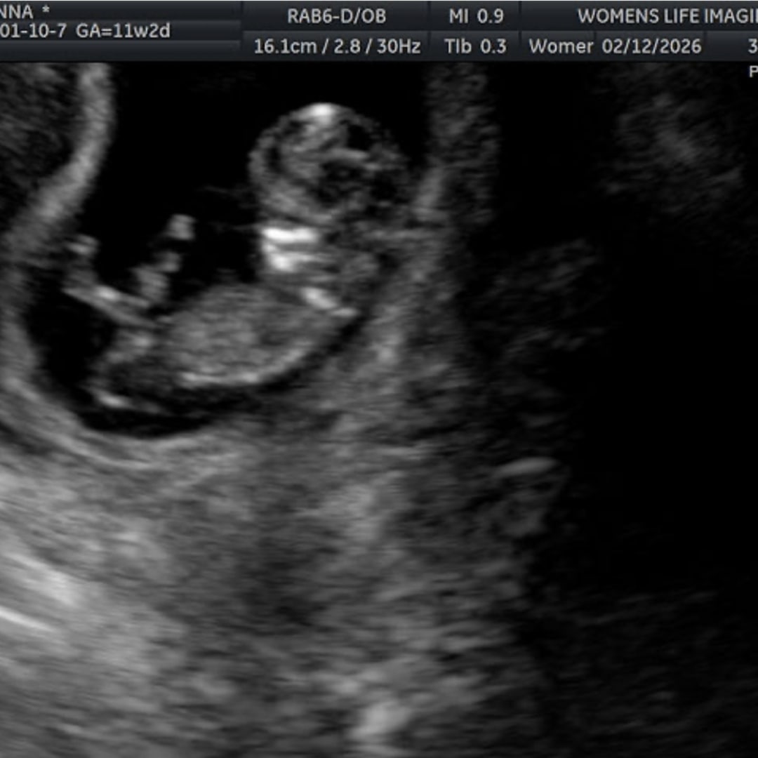 Photo shared by Gianna for their Babylist baby registry.