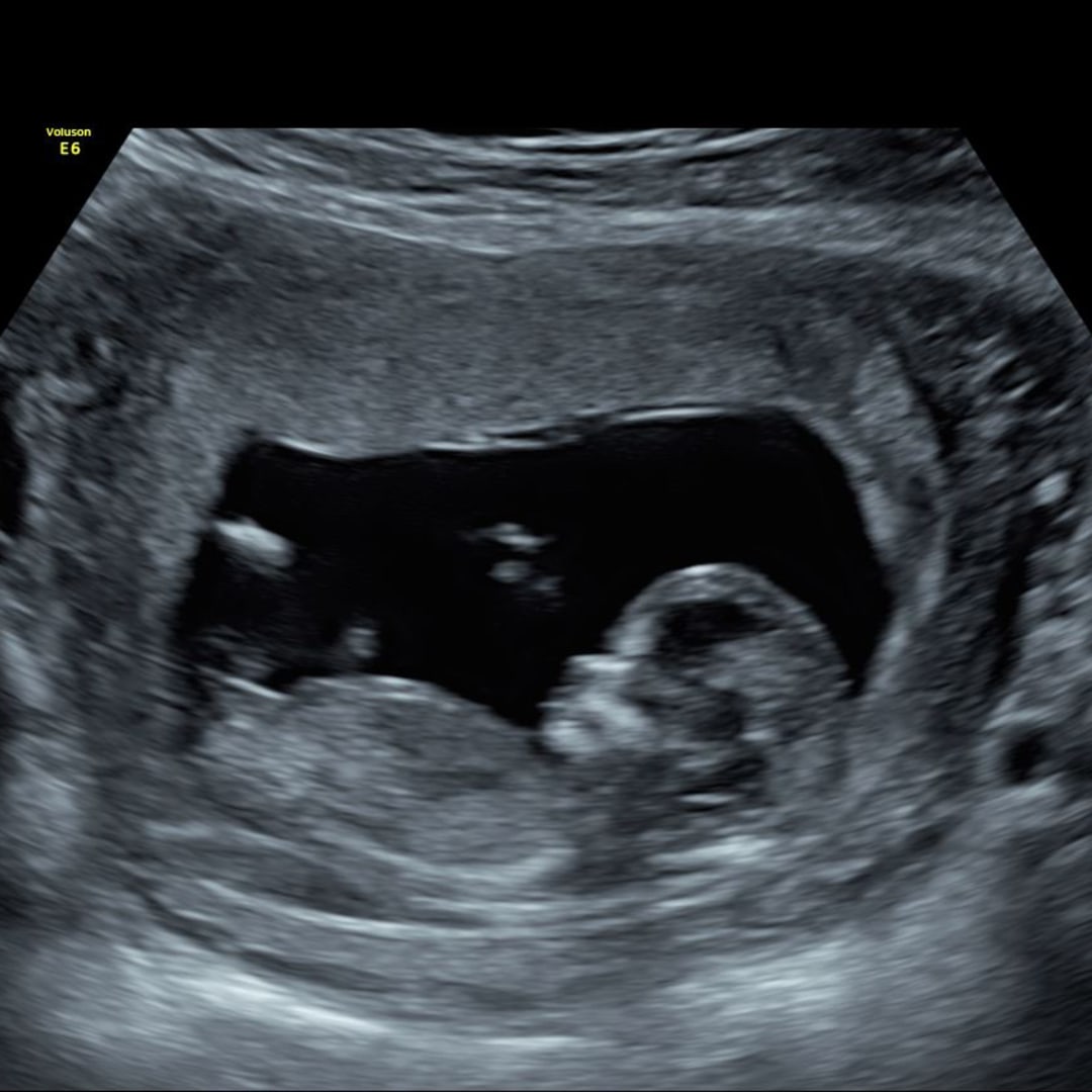 Photo shared by Hannah for their Babylist baby registry.