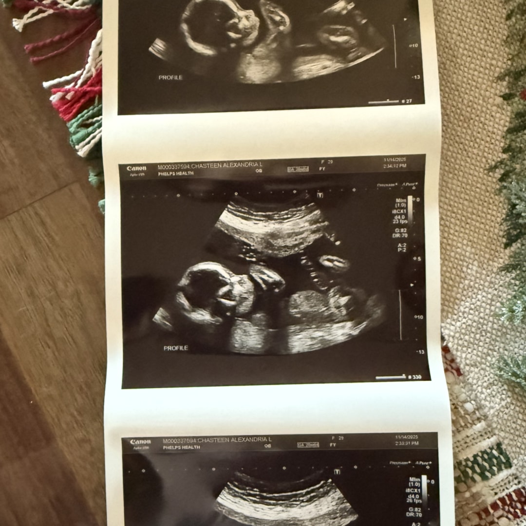 Photo shared by Alexandria for their Babylist baby registry.