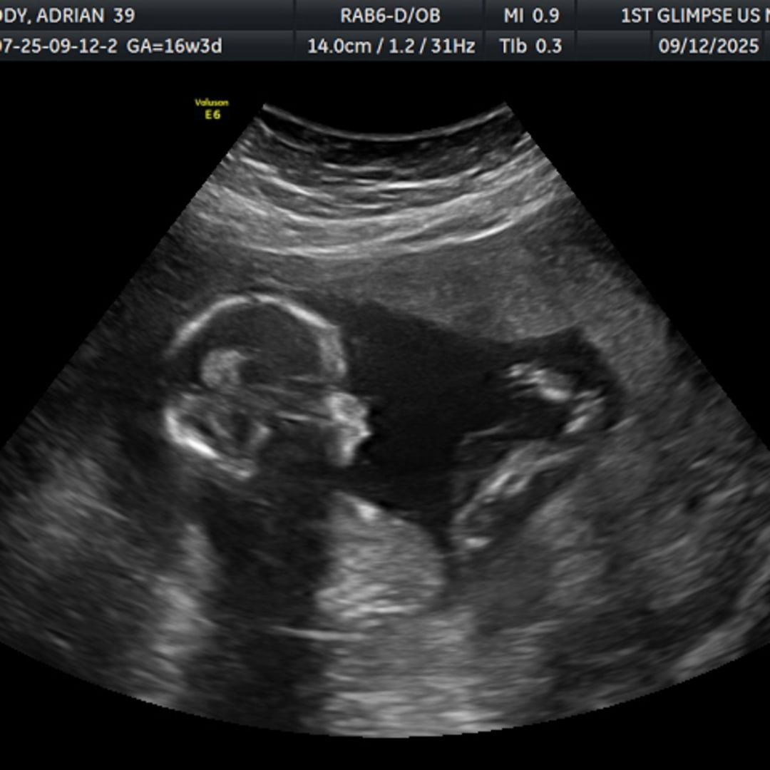 Photo shared by Adrian for their Babylist baby registry.