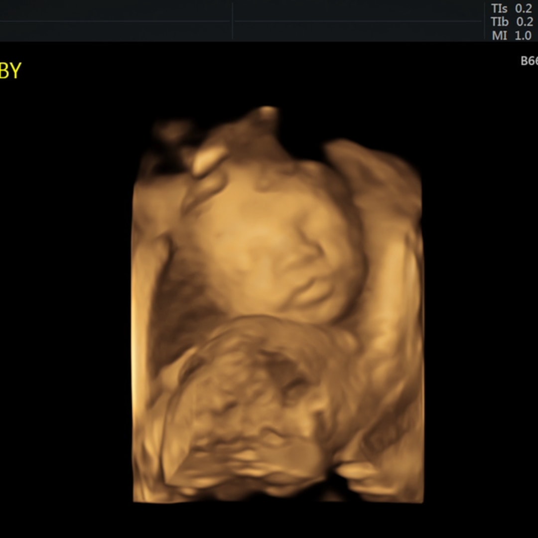 Photo shared by Alexa for their Babylist baby registry.