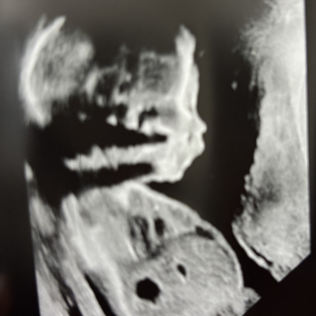 Photo shared by Doris for their Babylist baby registry.
