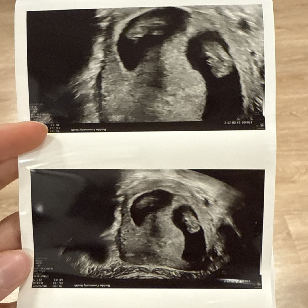 Photo shared by Rebekah for their Babylist baby registry.