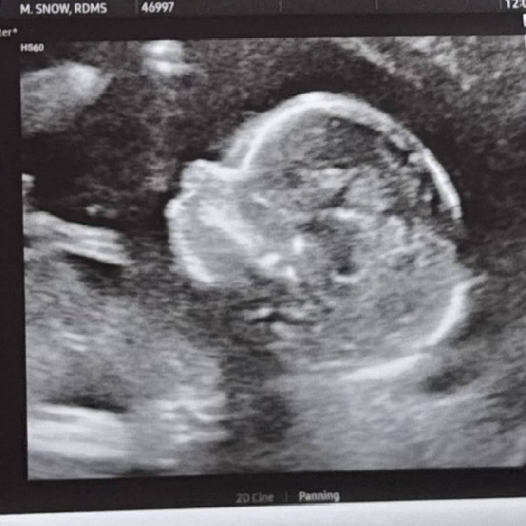 Photo shared by Allie for their Babylist baby registry.