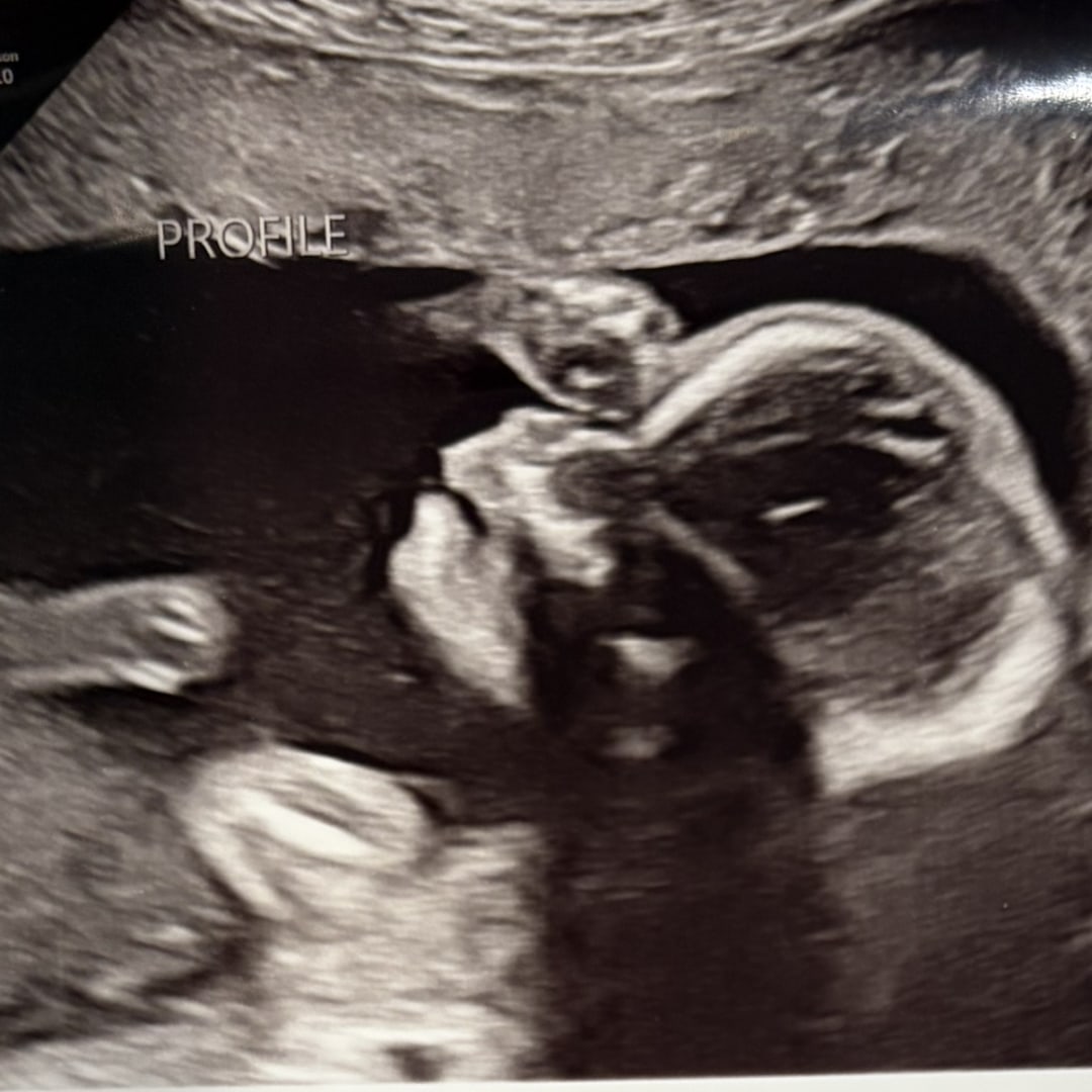 Photo shared by Annika for their Babylist baby registry.