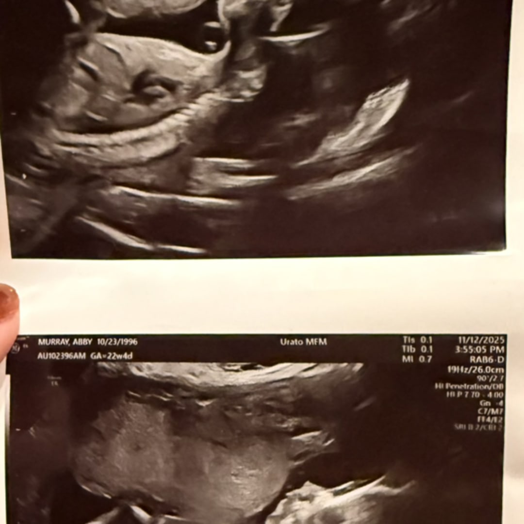 Photo shared by Abby for their Babylist baby registry.