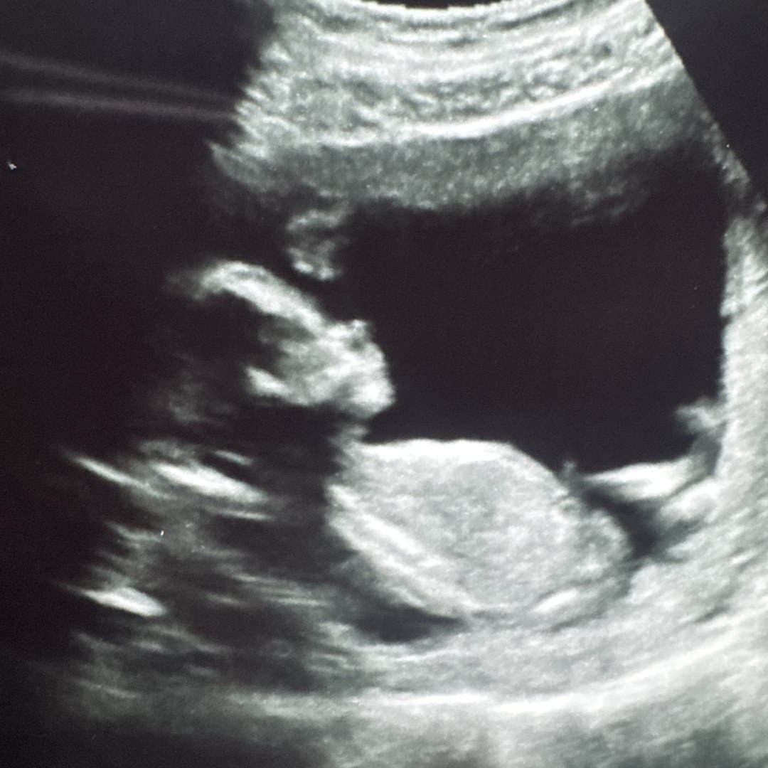 Photo shared by Krystal for their Babylist baby registry.