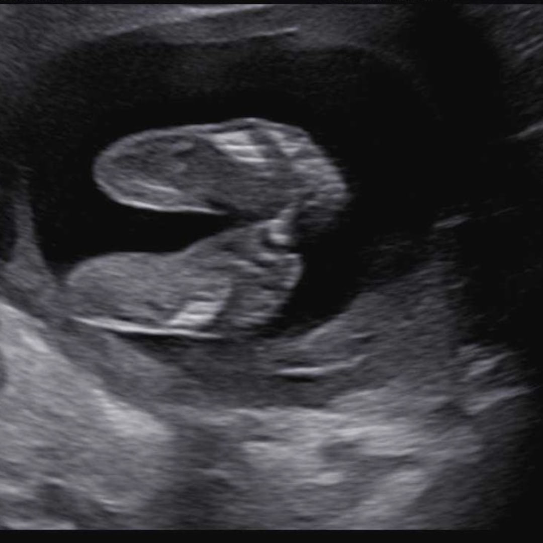 Photo shared by Morgan for their Babylist baby registry.