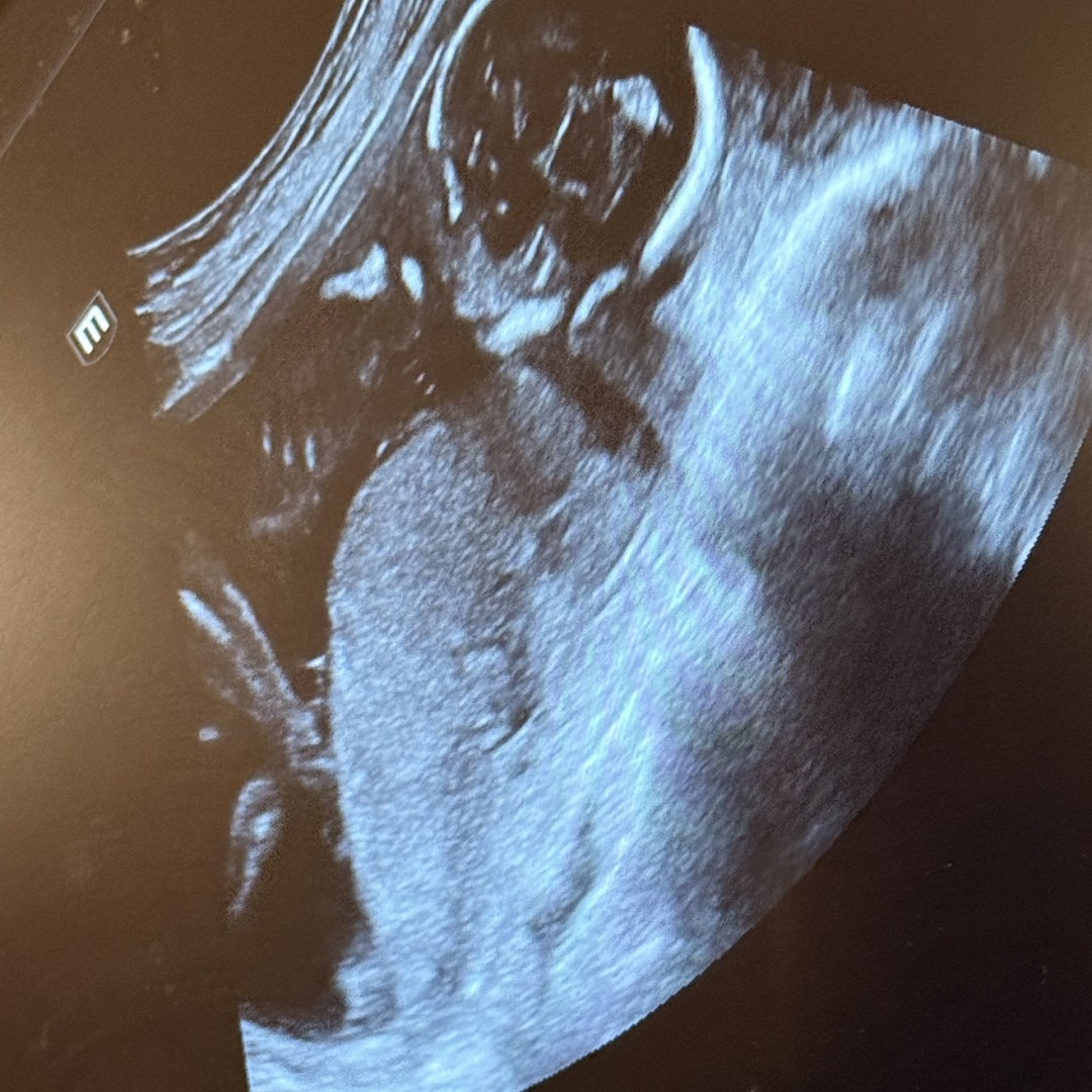 Photo shared by Toniah for their Babylist baby registry.