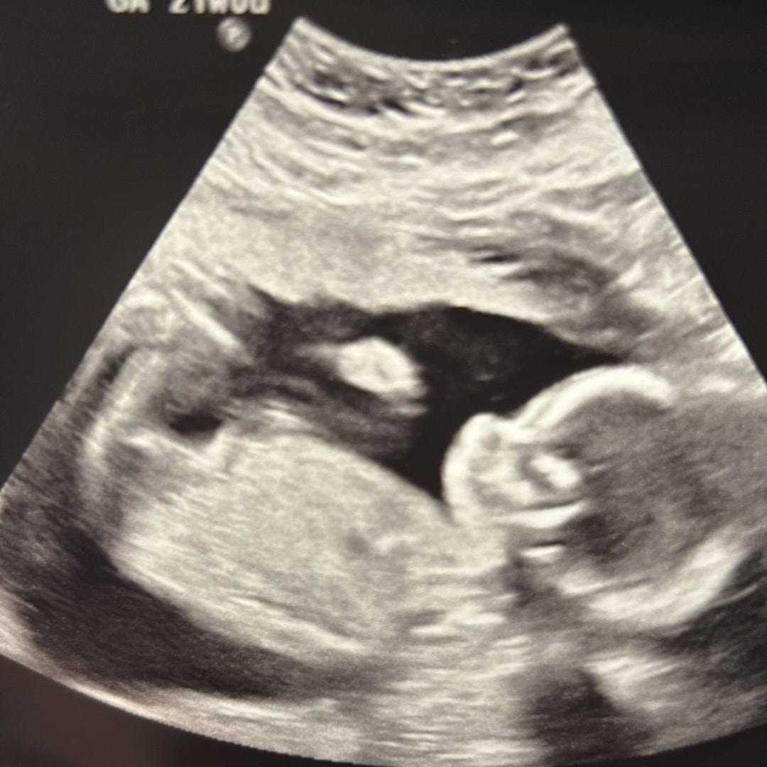 Photo shared by Brittney for their Babylist baby registry.
