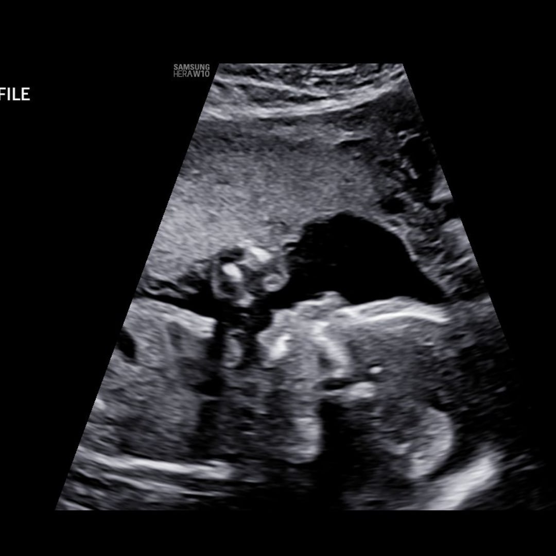 Photo shared by Alix for their Babylist baby registry.